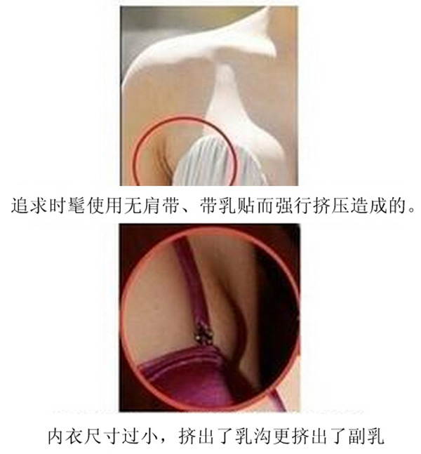 拒绝副乳—调整型内衣,我爱你的原因