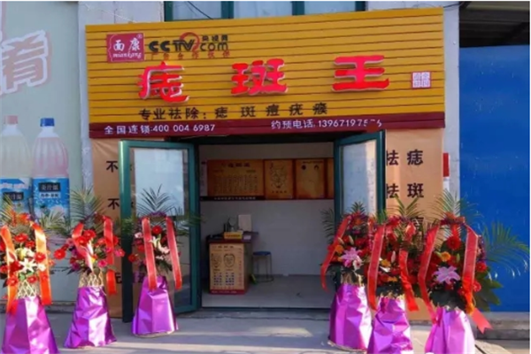 面康痣斑王加盟条件介绍