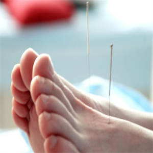  Acupuncture and moxibustion health center is invited to join